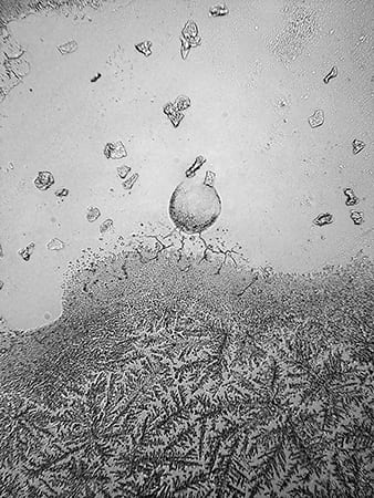 Do you cry easily, for no reason, for all or nothing? Article illustrated by microsop image of tears